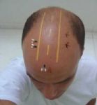 Semear para colher